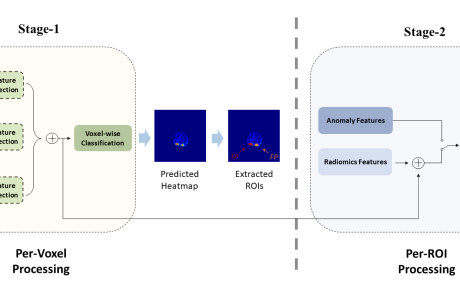 MCL Research on Prostate Lesion Detection from MRI Images