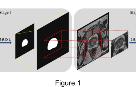MCL Research on Prostate Segmentation