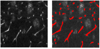 MCL Research on Segmentation of Mice Brain Images